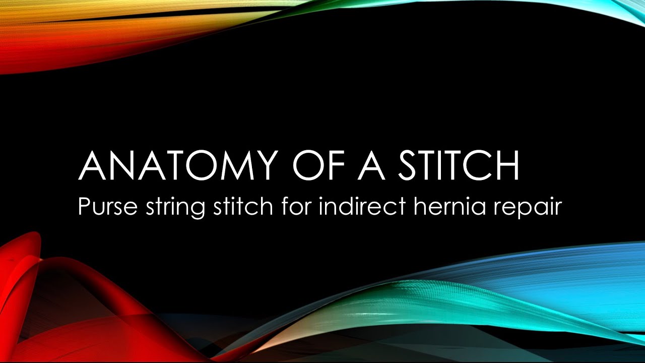 PDF) New procedure for purse-string suture in thoracoscopic esophagectomy  with intrathoracic anastomosis | Dejan Ignjatovic - Academia.edu