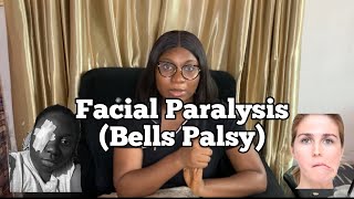 My BELL’s PALSY EXPERIENCE | I woke up with Facial Paralysis