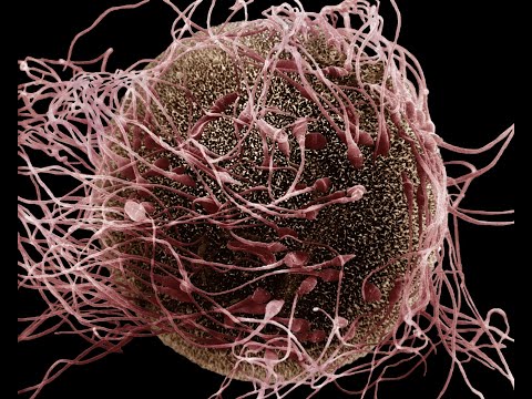 Inside the IVF Lab – Journey of an Oocyte & Sperm during IVF Process (OPU, Fertilization &  ET )