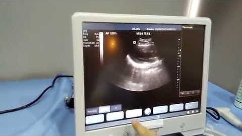 Cardiac Probe color doppler video/Protable touch screen USG for sale