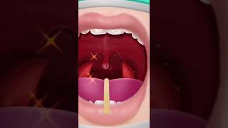 ASMR Remove heamadipsa stick in the throat | Mouth's deep cleaning