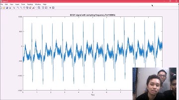 Digital Signal Processing Phase 3 by Group 3 UTM