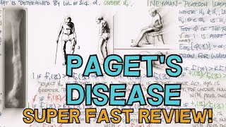 PAGET'S DISEASE OF BONE - FAST REVIEW - DEFINITION, CAUSE, STAGES, INVESTIGATIONS, MANAGEMENT PAGET'S DISEASE OF BONE - FAST REVIEW - DEFINITION, CAUSE, STAGES, INVESTIGATIONS, MANAGEMENT