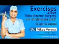 Exercises after tibia ilizarov surgery        dr vikas verma