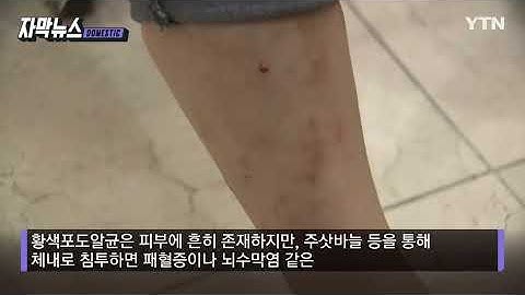 [자막뉴스] 그 병원 갔다가 줄줄이..."치명적인 균" 집단 감염에 사망·중태 / YTN