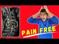 Chronic Neck pain recovery without surgery