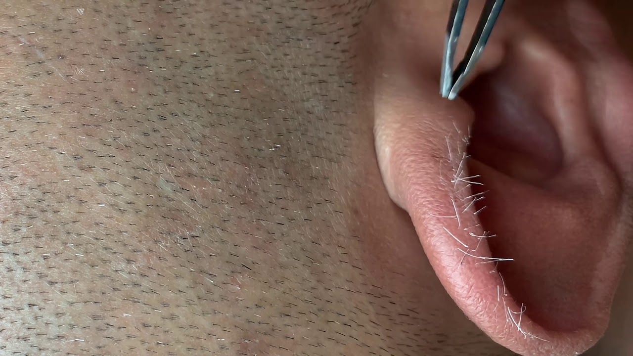 5 mins Plucking gray hair ep.3