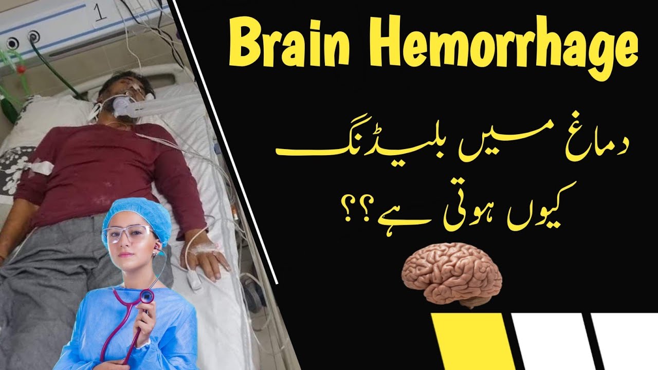 Brain Hemorrhage Causes Symptoms Diagnosis Treatment And Prevention 