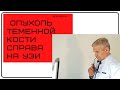 Опухоль теменной кости справа на УЗИ