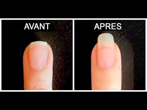 Faire Vite Pousser Ses Ongles Rapidement Et Les Fortifier