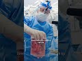 A revolution in organ transplants is here #xenotransplantation