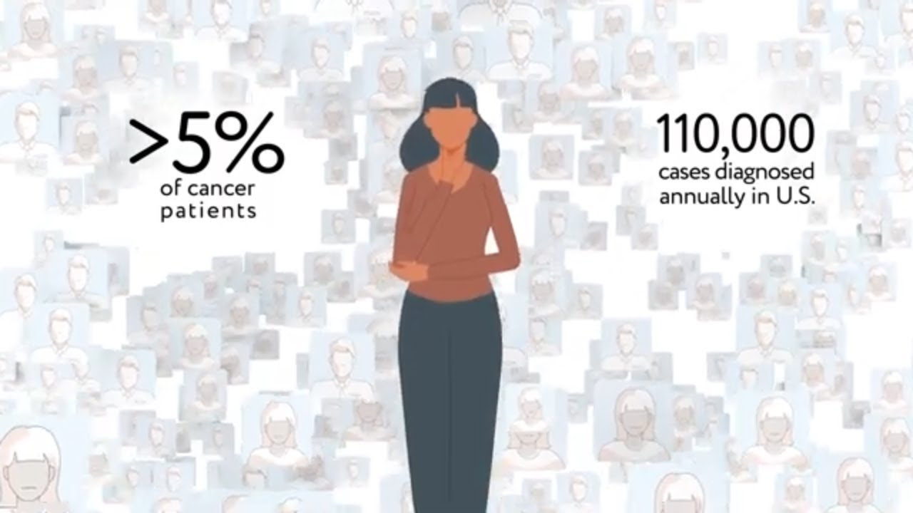 Plus Therapeutics' ReSPECT-LM Clinical Trial for Patients with Leptomeningeal Metastases