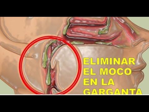 Video: Cómo No Caer En El Cebo MMM
