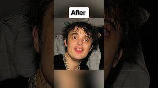 Celebrities before and after using Drugs 😳#shorts