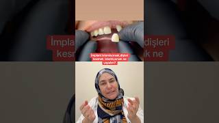 İmplamt Istemiyorsanız