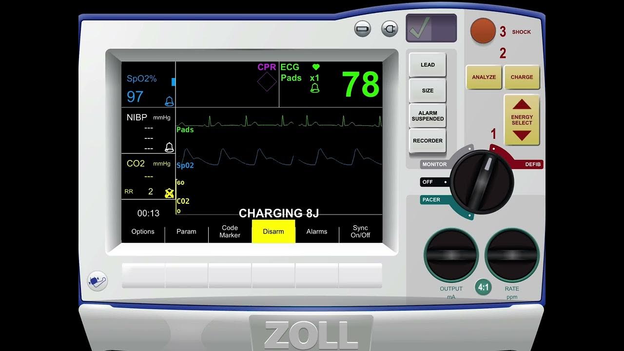 ZOLL R SERIES 30J test shock (CHECK DESCRIPTION) - YouTube