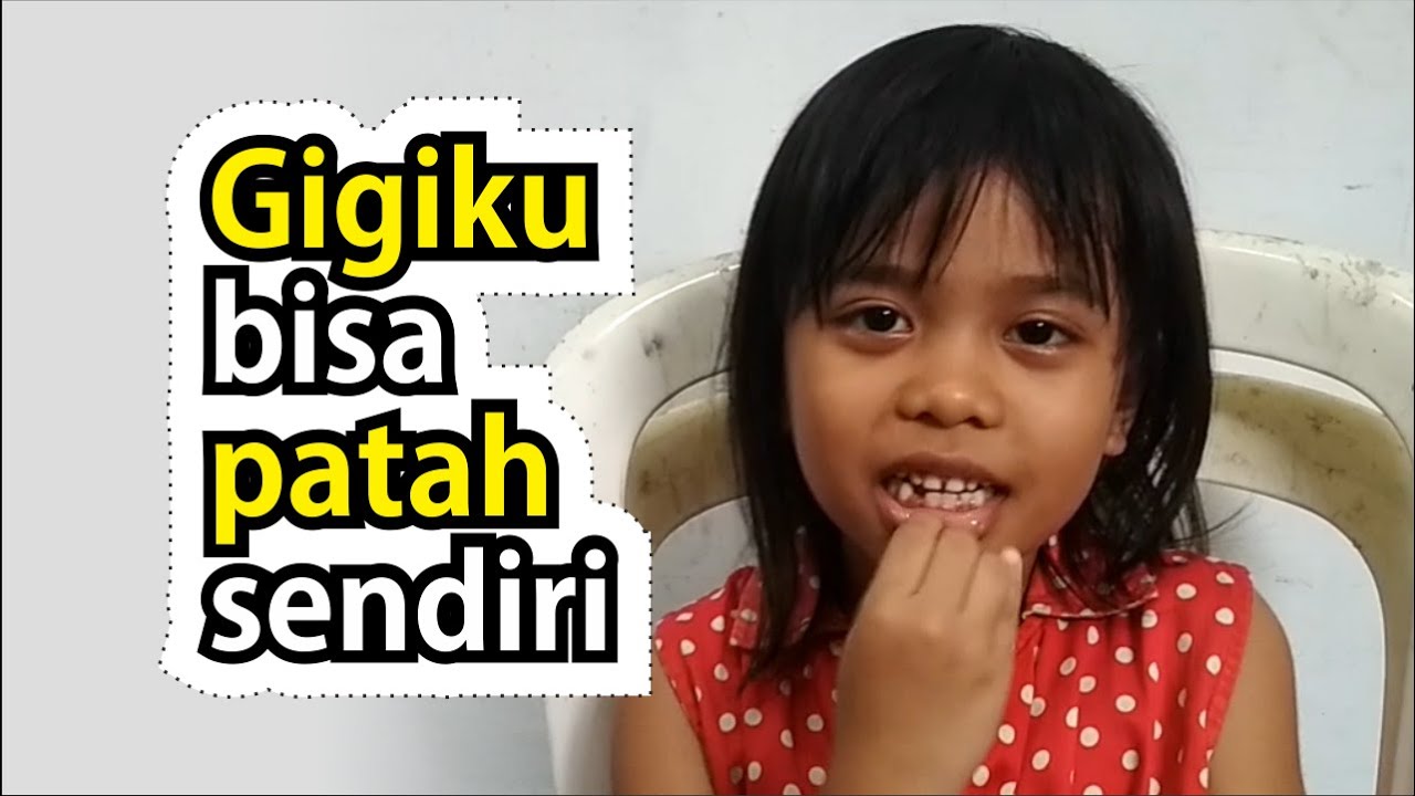 Gigi goyang bisa copot sendiri 