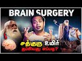      sadhguru brain surgery  mrgk