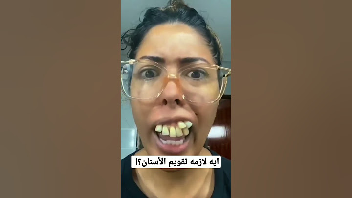 إيه لازمه تقويم الأسنان؟!