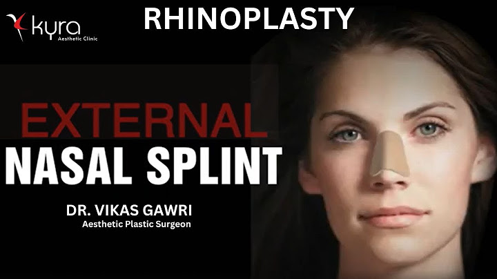 Nasal Splint after Rhinoplasty | Nose Splint After Nose Surgery | Kyra Aesthetic Clinic