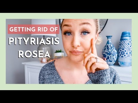 PITYRIASIS ROSEA | HOW I GOT RID OF IT FAST | Laura-Lee