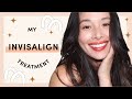 My Invisalign Journey | What To Expect | Aja Dang