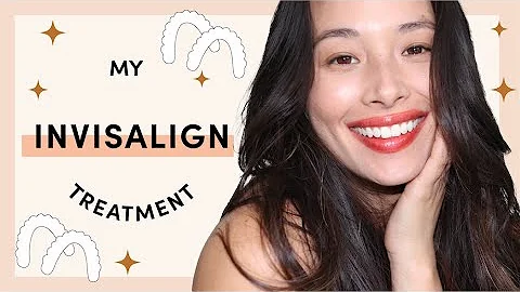 My Invisalign Journey | What To Expect | Aja Dang
