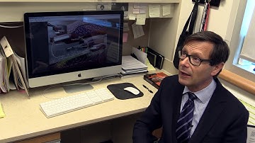 Islet transplant innovation