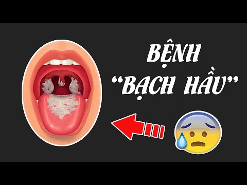 Hiểu rõ về bệnh Bạch hầu trong 5 phút