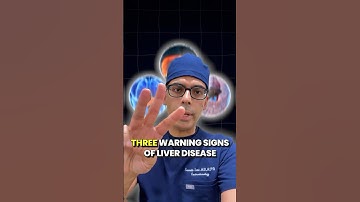 3 Tanda Peringatan Penyakit Hati yang Tidak Boleh Anda Abaikan ❌ Dokter Harvard