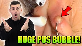 Reacting To Infected Conch Piercing Popping! *Warning PUS*