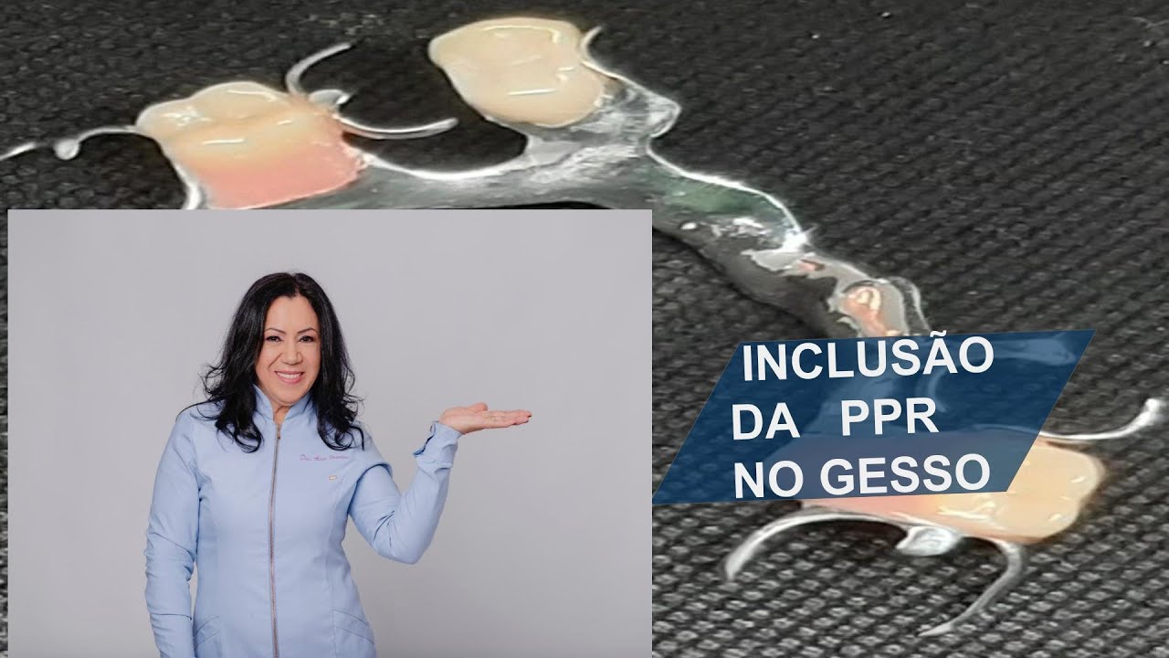 confecção de PPR  iNCLUSÃO