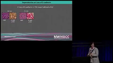 Lobular Breast Cancer: Whats coming/Whats promisin...