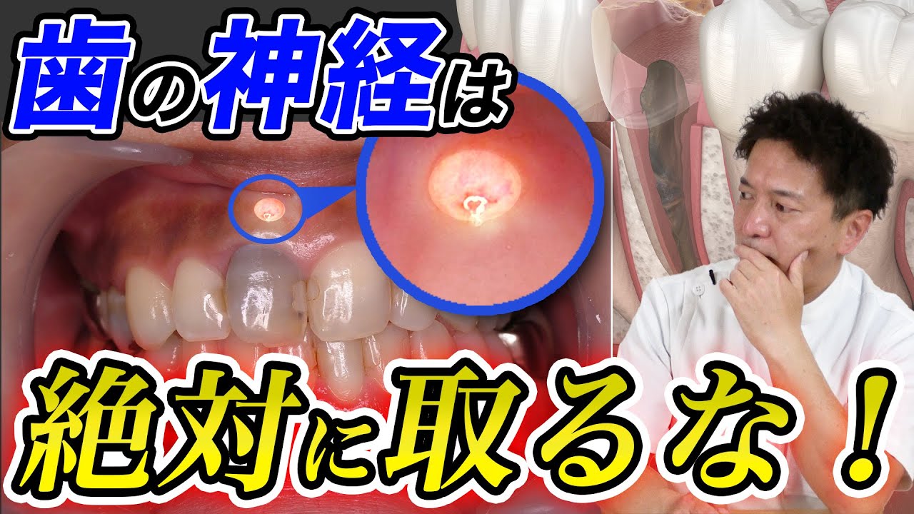歯の神経を取ると起こる３つの悲劇
