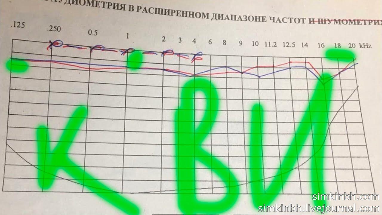Генератор импульсов на транзисторах разной проводимости. Ув4 и ум5 в мажоре и миноре. Как увеличить диапазон. Как увеличить диапазон. Как увеличить диапазон.