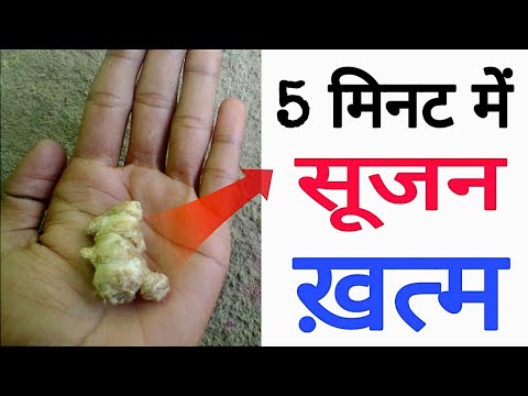 5 मिनट में सूजन खत्म करे । सूजन दूर करने के उपाये ! sujan ka ilaj