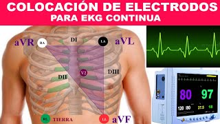 ¿COMO COLOCAR LOS ELECTRODOS PARA MONITORIZACIÓN? (EKG CONTINUA) MONITOR MULTIPARÁMETROS