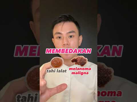 Video: Adakah semua tahi lalat bersisik barah?