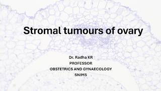 Stromal tumours of ovary