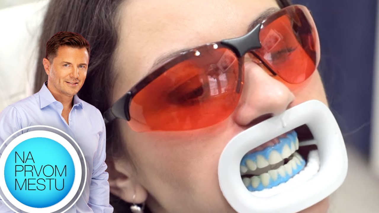 Beljenje zuba | Stomatolog dr Miloš Milošević | Na prvom mestu
