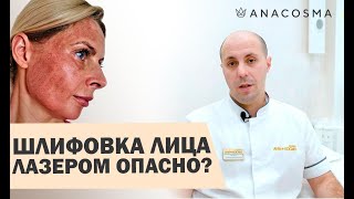 🔥Лазерная шлифовка лица 🔥ОПАСНО?🔥 Восстановление, ДО и После