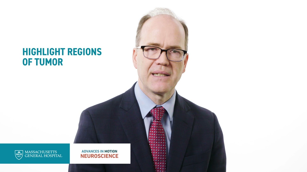 New Advances in Glioma Surgery