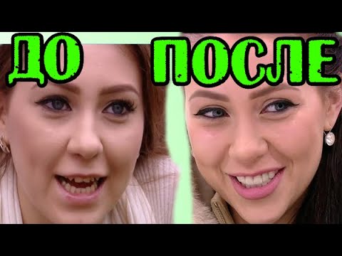 АЛЁНА РАПУНЦЕЛЬ ДО И ПОСЛЕ ПЛАСТИКИ!