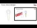 Crown- down Technique| ENDODONTICS |