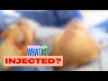 Mysterious Substance Removed from Breasts (Throwback Episode)