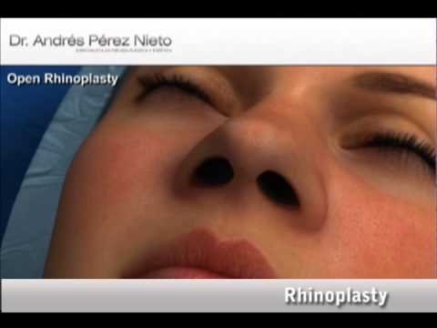 camera iphone 8 plus apk rhinoplasty en 1