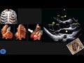 Echocardiographic anatomy part 1 plax parasternal long axis