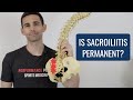 Is Sacroiliitis Permanent?