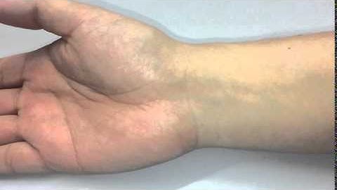 Heart beat amplification using Eulerian video magnification