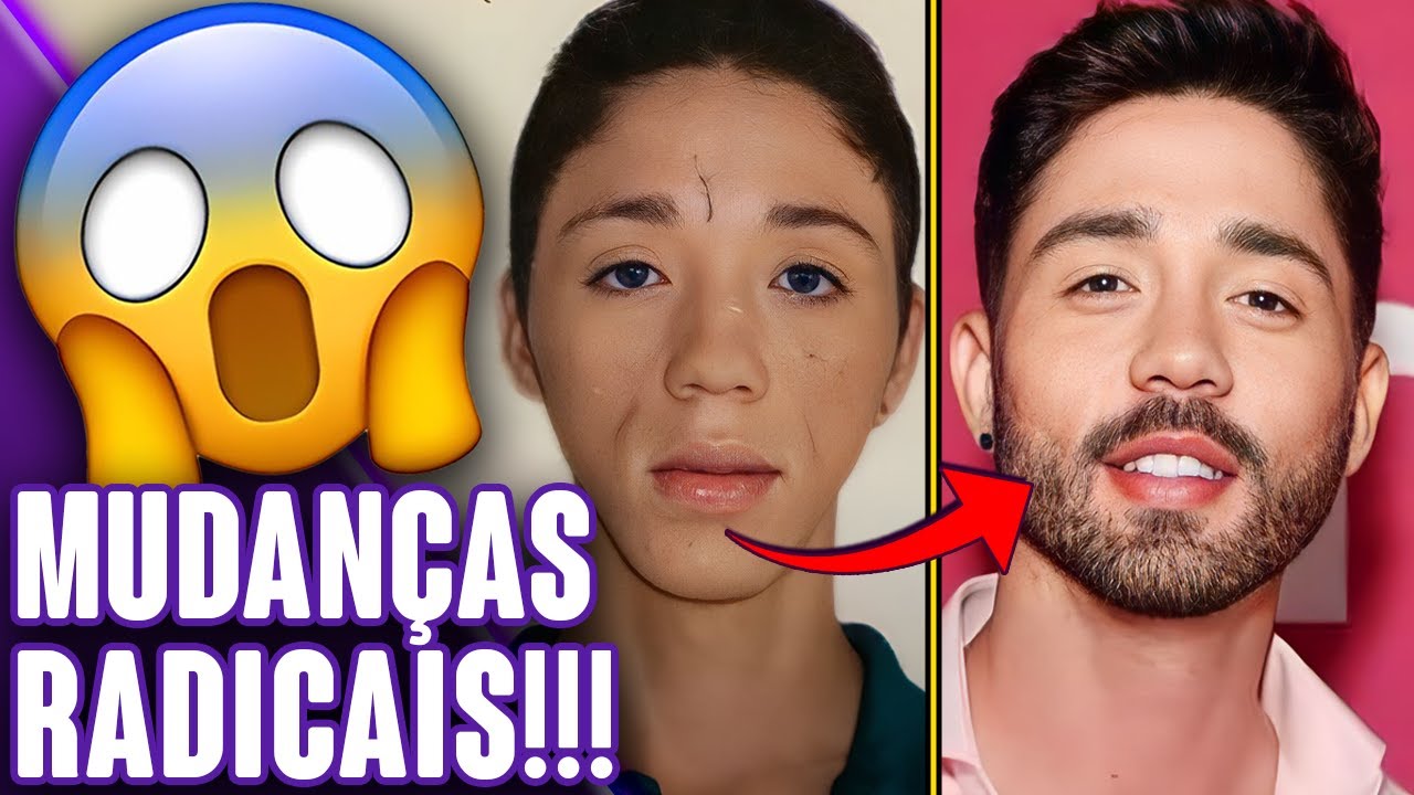 FAMOSOS QUE FIZERAM HARMONIZAÇÃO FACIAL E FICARAM MUITO DIFERENTES! - PARTE 2 | Virou Festa